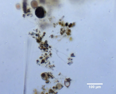 Phytoplankton 1 MHI